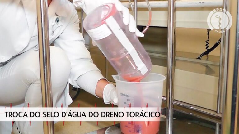Drenagem Tor&aacute;cica em Selo d’&Aacute;gua: Princ&iacute;pios e Pr&aacute;ticas Essenciais