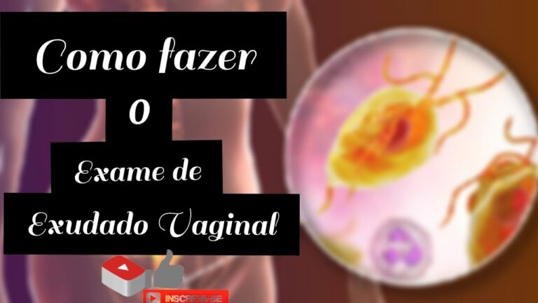 Amostras de Exsudados: M&eacute;todos e Import&acirc;ncia na An&aacute;lise Cl&iacute;nica